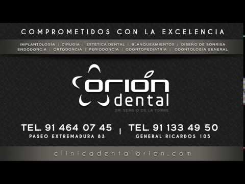 clinica dental madrid