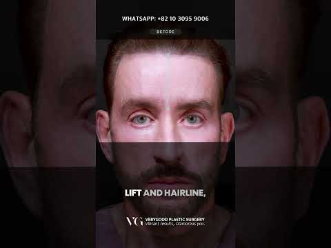 Renewing Facial Rejuvenation Procedures in South Korea for International Patients