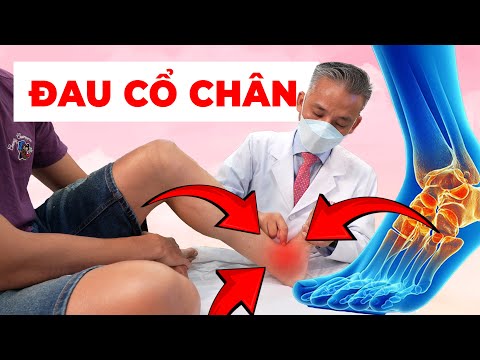 Cổ Chân Đau Dài Lâu? Tìm Ra Giải Pháp Ngay Trước Khi Quá Muộn!