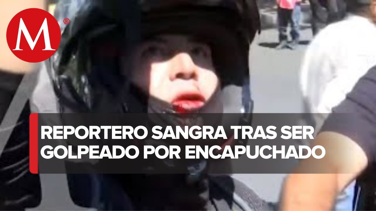 Encapuchados agreden a camarógrafo de Multimedios