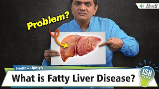 What is Fatty Liver Disease?