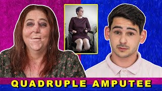 Quadruple Amputee Shaninlea Visser / Wide Awake Podcast EP.4