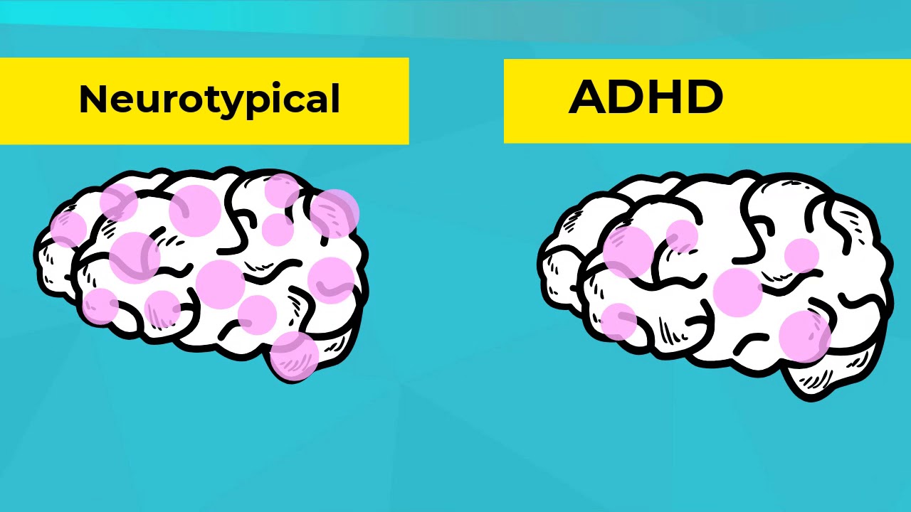 Infographics: What is ADHD?