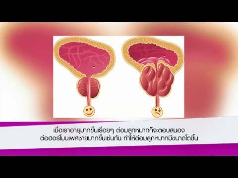 การดำเนินการเพื่อเพิ่มความแรงแท็บเล็ต นักมวยและความแข็งแรง