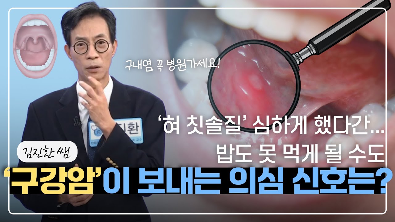 [#구내염 #구강암] 단순 구내염인 줄 알았는데… 구강암 초기 신호일 수도 있습니다ㅣ건강매거진