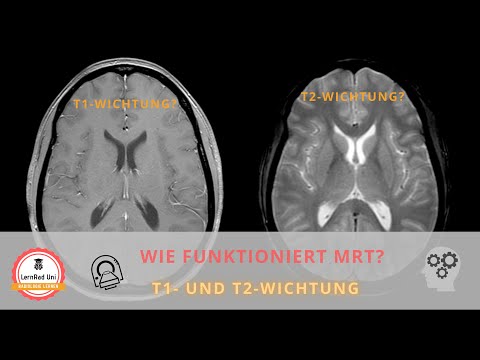 Wie funktioniert MRT? T1- und T2-Wichtung verständlich erklärt