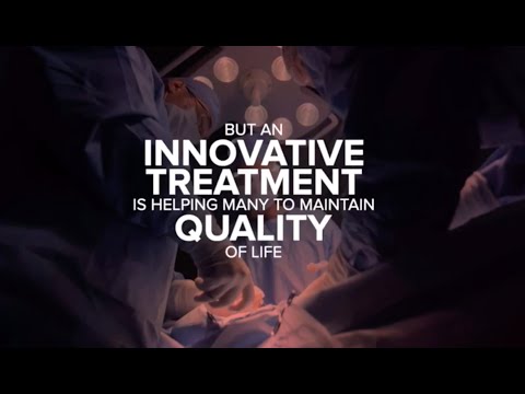 High-Intensity Focused Ultrasound (HIFU) for Prostate Cancer: First US Study