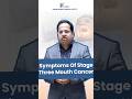 Stage 3 मुँह का कैंसर के लक्षण क्या हैं Oral Cance