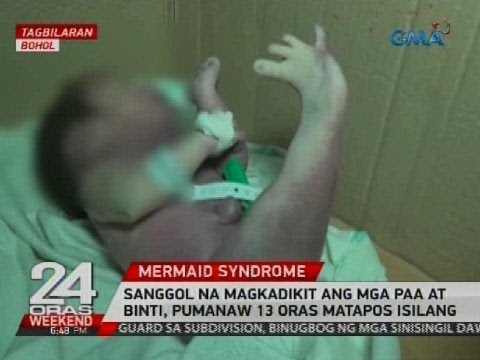 Apple diyeta sa mawala timbang sa 10 kg bawat linggo larawan mga review bago at pagkatapos ng Roller slimming ilalim pabalik