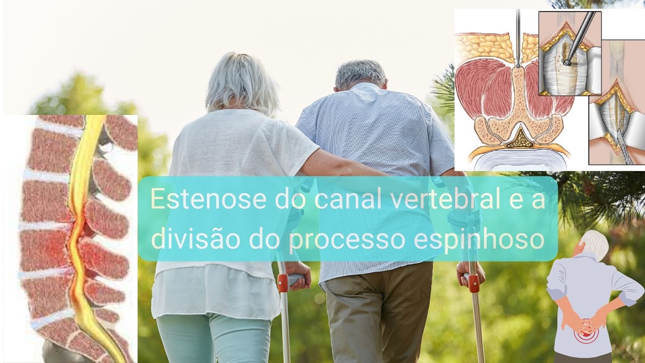 Marco Aurélio Severo Da Silva Versiani-78