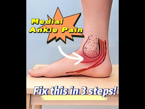 Medial Ankle Pain? It's Easy to Fix....