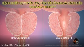 UROLIFT - PHƯƠNG PHÁP ĐIỀU TRỊ BỆNH SÓN TIỂU VÀ NHIẾP HỘ TUYẾN LỚN Ở NAM GIỚI