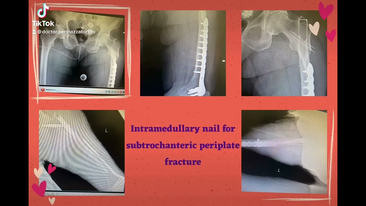 Davide Pennazzato-46