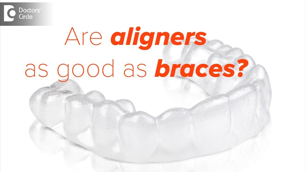 Are aligners as good as braces? - Dr. Nishanth Shetty