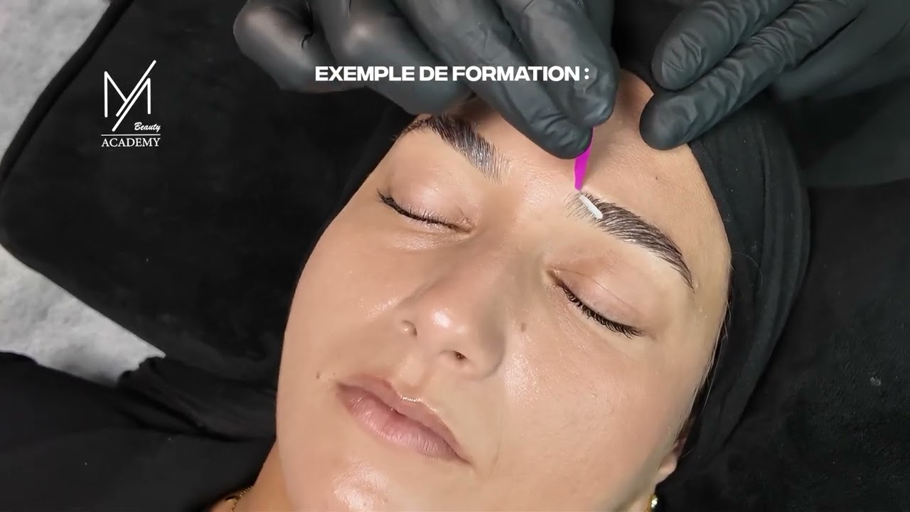 Browlift