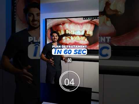 Cum reconstruim un zâmbet afectat sever: Plan de tratament în 60 de secunde🦷