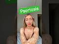 What Is Psoriasis? #shorts