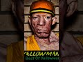 Quick History Of Yellowman's Legendary  Career