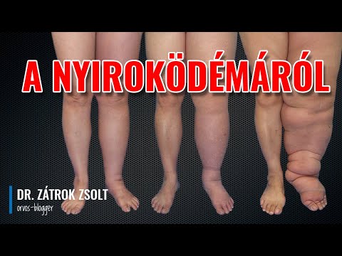 krónikus boka sérülések a térdízületek fájdalma okozza annak megjelenését