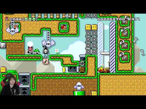 Never Seen This Happen Before - Super Expert (no skips) #48