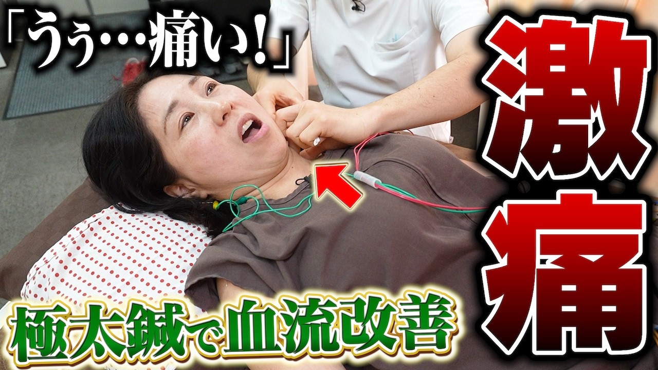 【脳過敏】極太鍼で血流改善｜痛みを抱えた左足が…