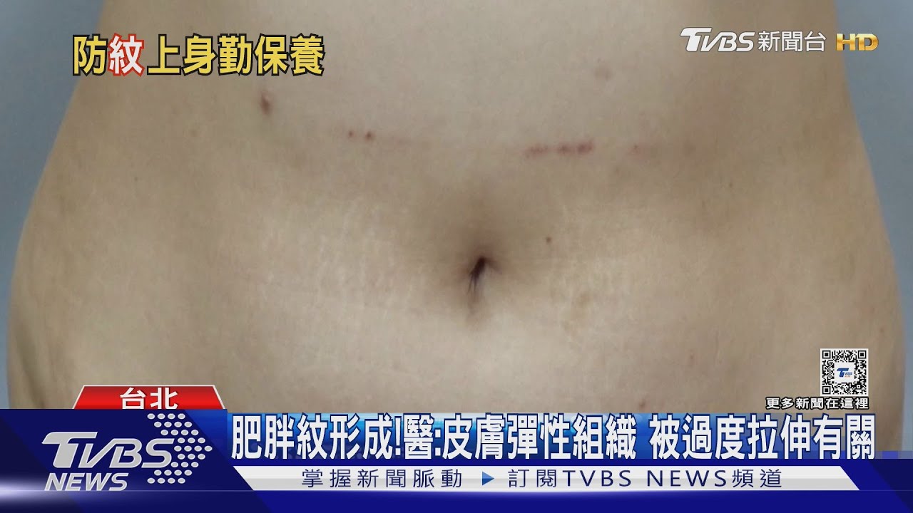皮膚突然出現「這狀態」 醫師:爬滿肚且「不可逆」