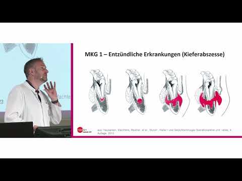 medArt 2023 Montag 06 MKG für Hausärzte F M Thieringer