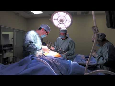 Weight Loss Surgery Procedure by Dr. Galileo Villarreal