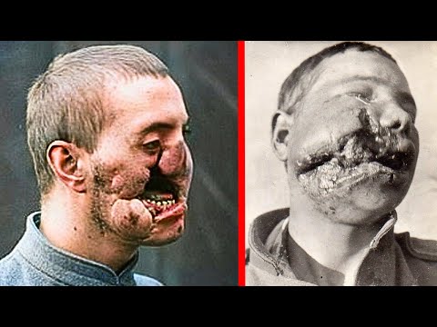 Was im BLOCK 11 von Auschwitz geschah, war SCHLIMMER als der T0D