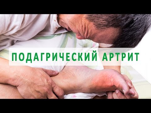 Боли в суставах рук и ног причины и лечение лекарства Может ли болеть спина от гормональных таблеток
