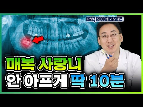  #사랑니 빼는 거 무서운 분들 필수 시청!