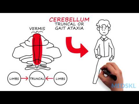 Neurology – Ataxia (Gait) – By Wendy Stewart M.D.