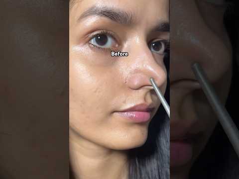Temukan rahasia kecantikan yang kamu cari! Cek produk ini dan berikan kulitmu perawatan terbaik! 🌟✨