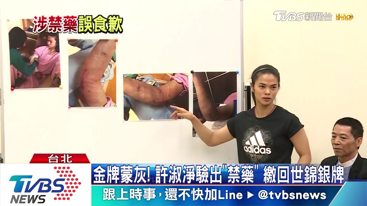 金牌蒙灰!許淑淨驗出「禁藥」 繳回世錦銀牌