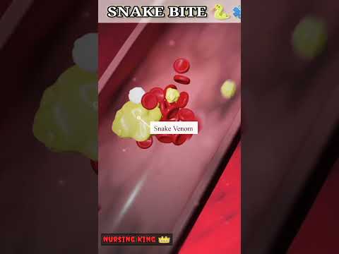 Snake bite🐍 । how to survive a venomous snake bite।#shorts #viral #medical