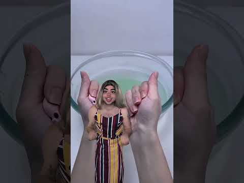 O amigo quebrou o braço e a criança só pensa: “Todo mundo vai assinar o gesso dele!” 💀🤣#POV #Humor