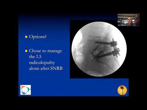 Degenerative Reconstruction: Why Alignment Matters