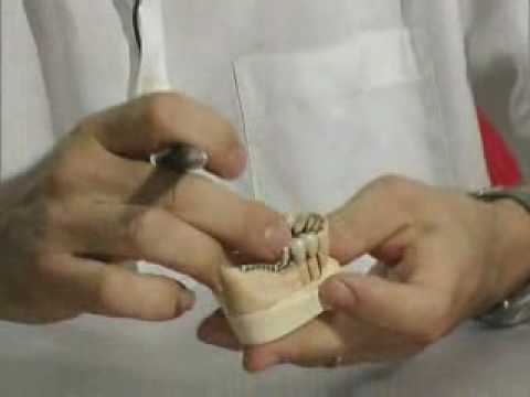 Milling Techniques Part 1