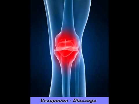 Vszupeuen - Dlaczego