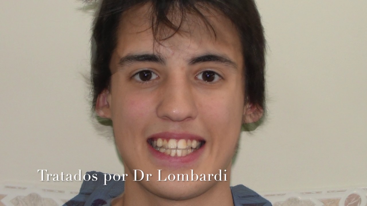 Maximiliano J. Lombardi-10