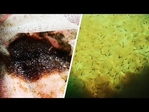9 and 10 days old Baby Koi development | #9