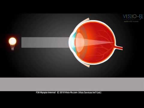 Cum să restabiliți vederea și imunitatea