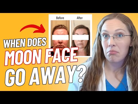 Moon Face from Prednisone: How Long Does It Take to Go Away?