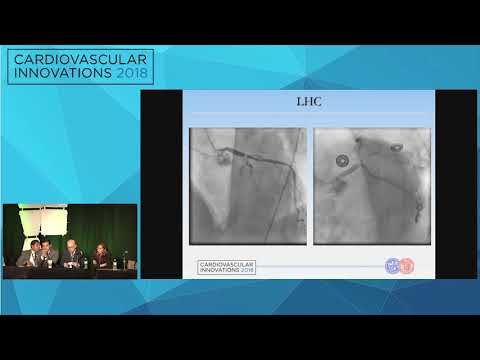 CVI2018 Session: My Best Case of the Year - Dmitriy Feldman, MD