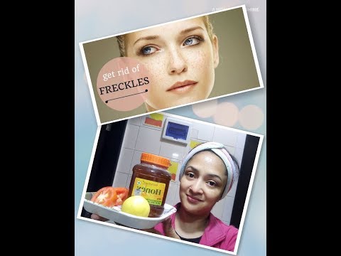 Get Rid Of Freckles/Dark Spots From Skin...