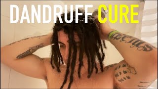 How to Get Rid of Dreadlock Dandruff EASY (no special product)