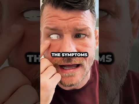 Bisping’s Second Eye Was In Serious Danger 👁️