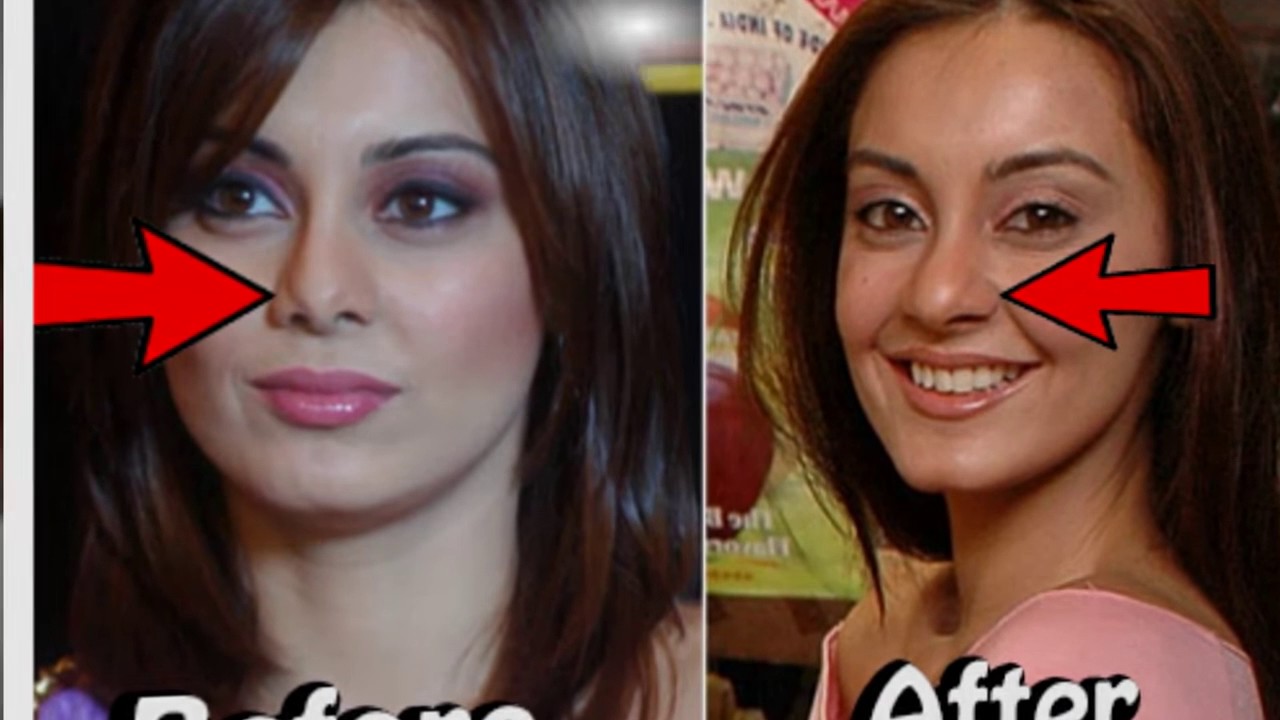 Bollywood Actress    Deepika Padukone Oops Moment    Shocking Wardrobe Malfunction  Oops Moment   Yo