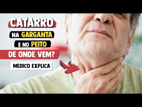 De onde vem o CATARRO que desce na GARGANTA e o do PEITO? │ Médico Explica