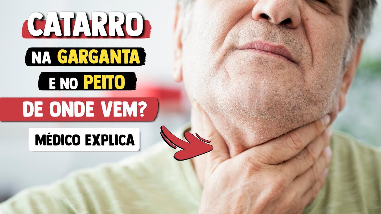 De onde vem o CATARRO que desce na GARGANTA e o do PEITO? │ Médico Explica